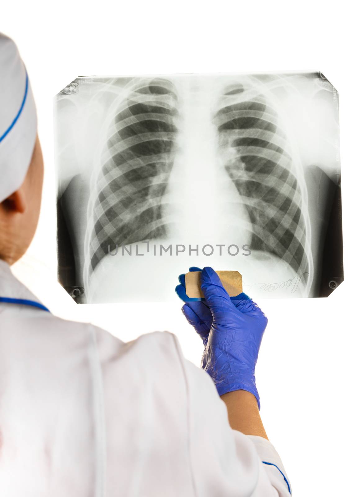 Doctor is looking X-ray of the chest