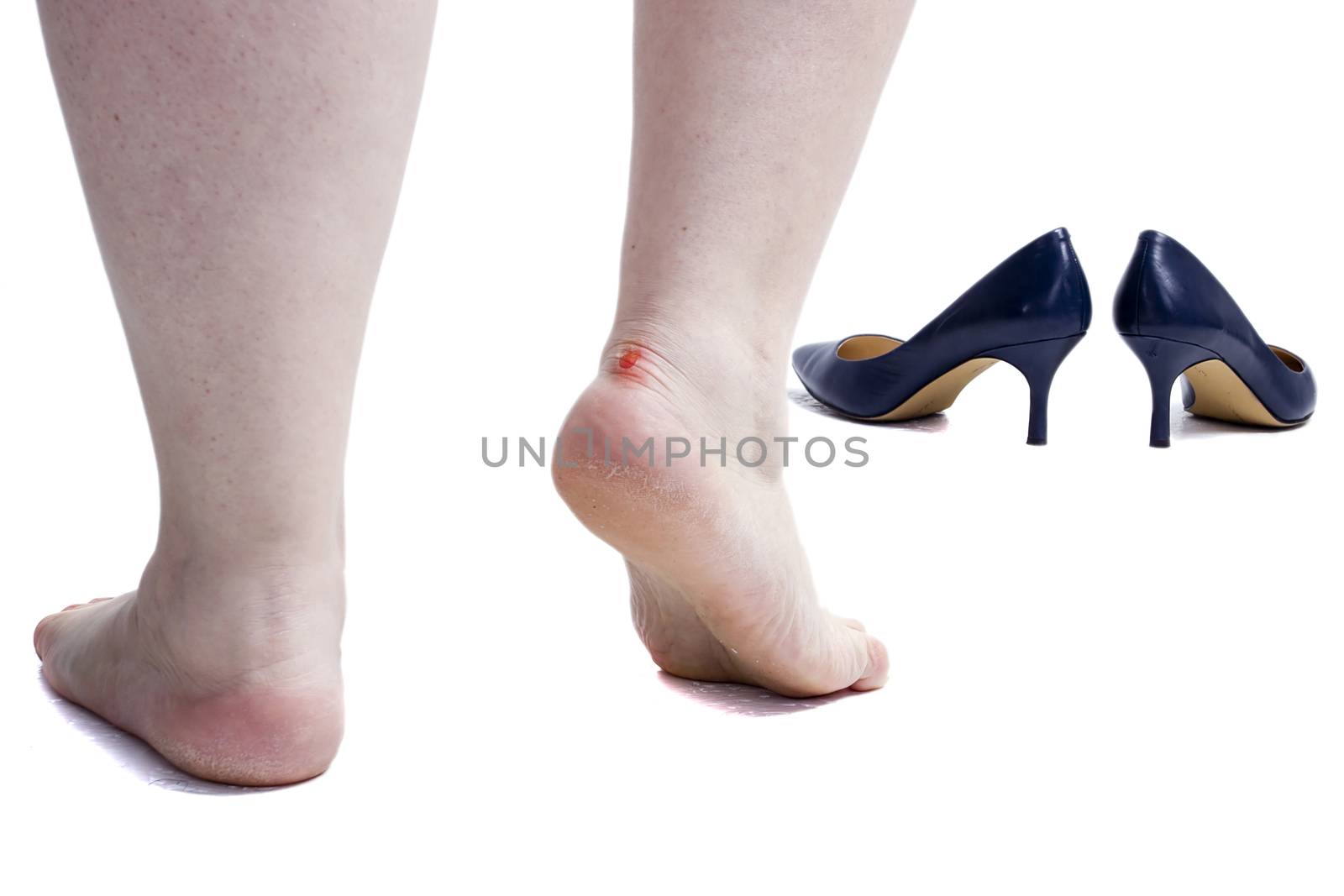 Female legs with callus on foot isolated on white background