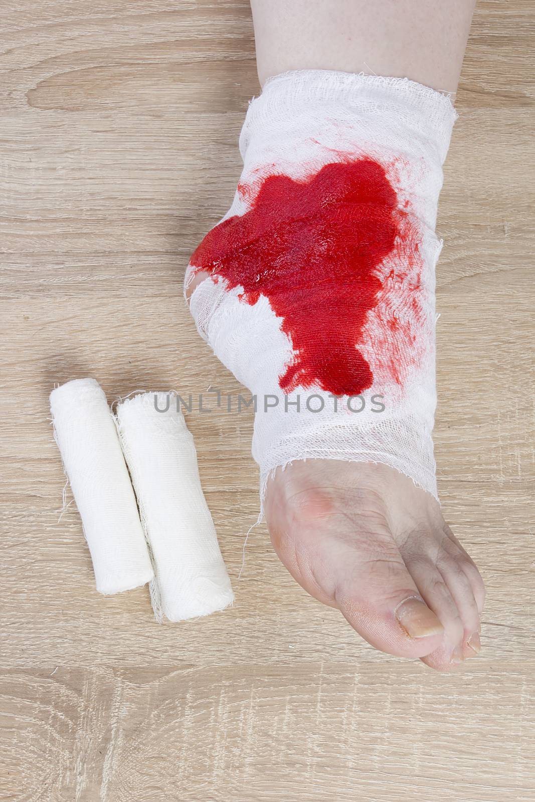 White medicine bandage on human injury foot