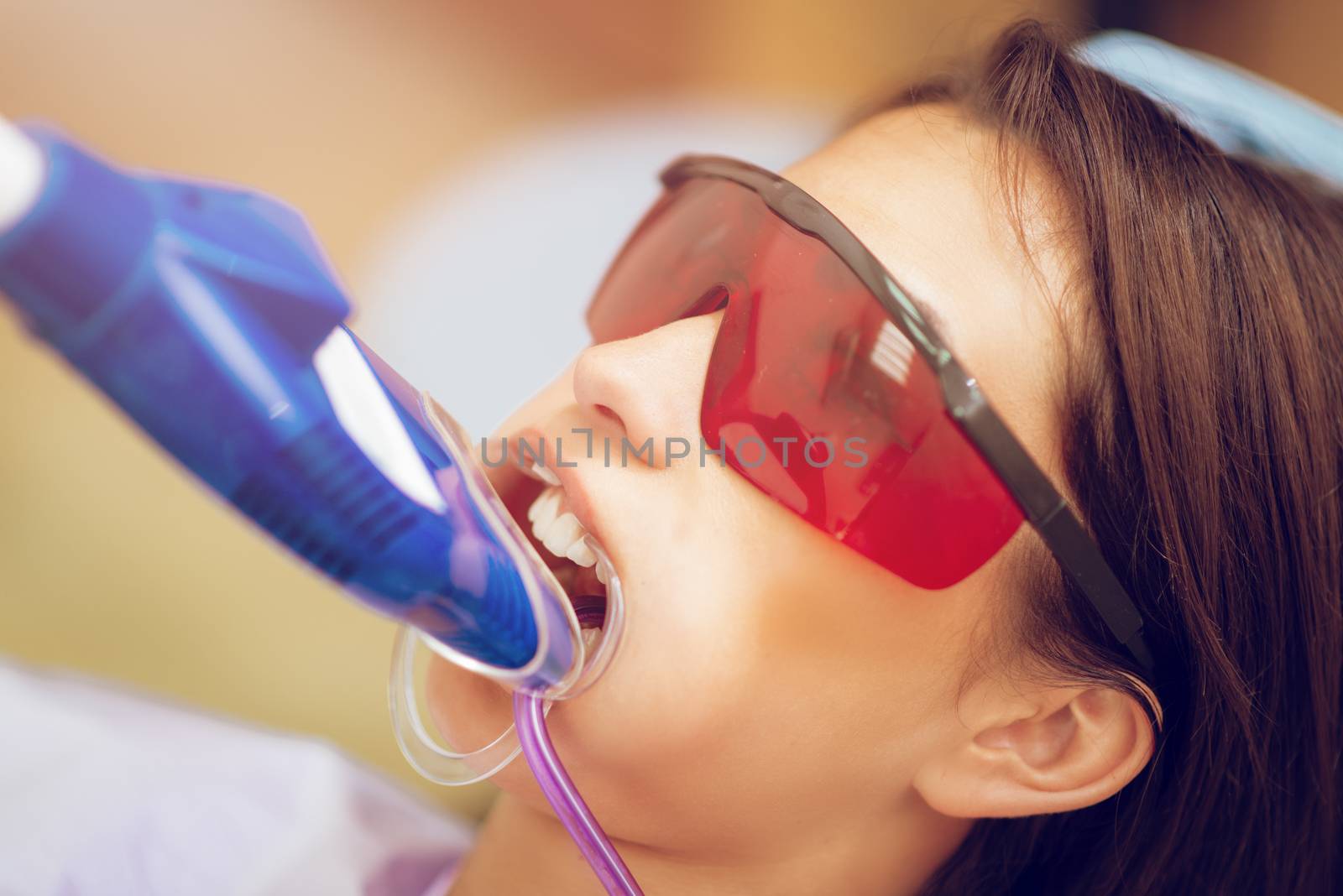 Beautiful young woman in visit at the dentist office. She is whitening teeth with ultraviolet light. Close-up.