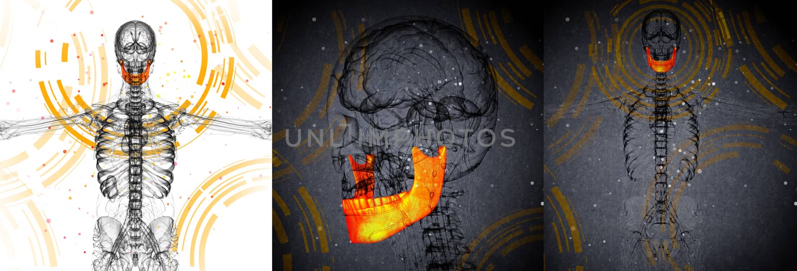 3D rendering medical illustration of the jaw bone 
