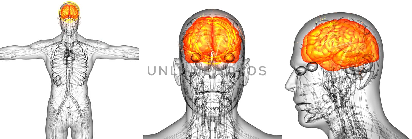 3d render medical illustration of the human brain pain - back view