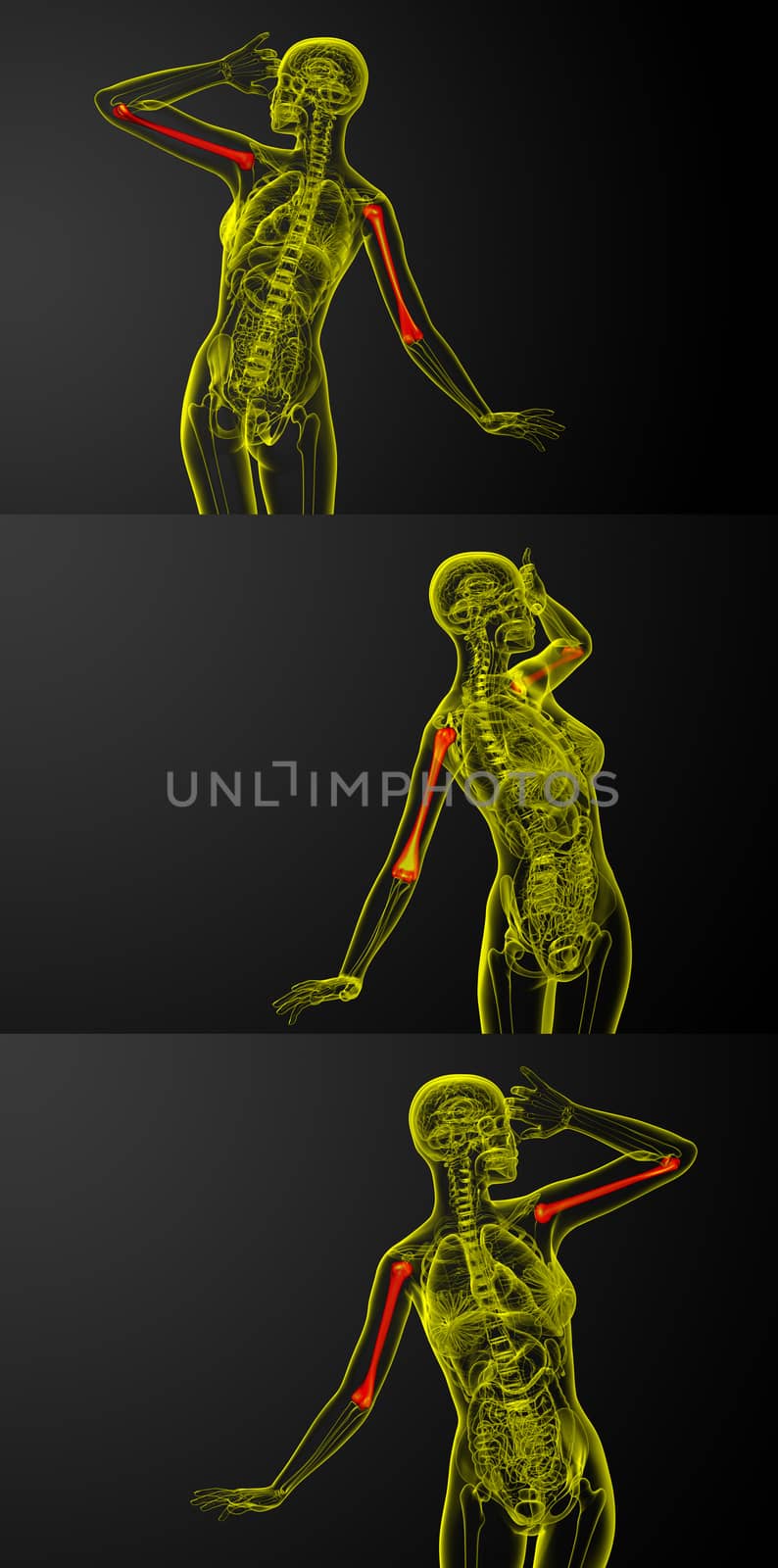 3d rendering medical illustration of the humerus bone