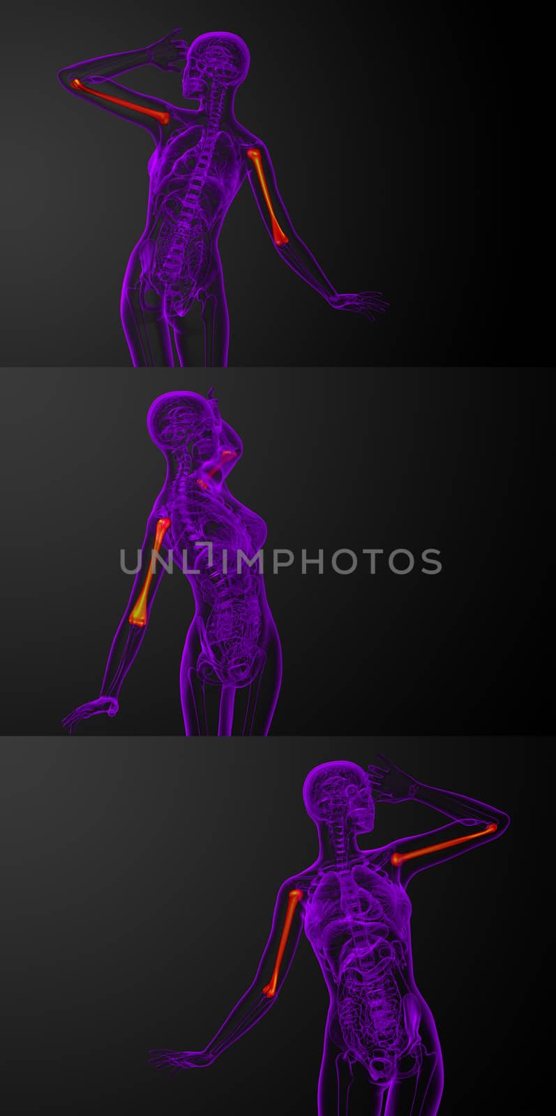 3d rendering medical illustration of the humerus bone