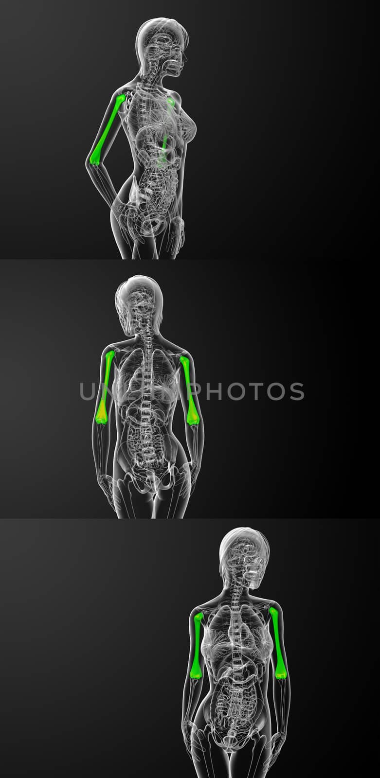 3d rendering medical illustration of the humerus bone