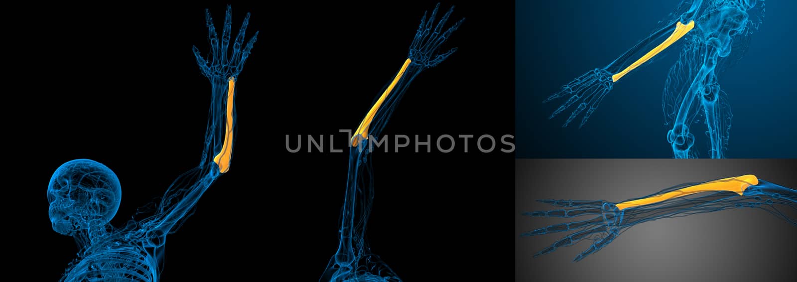 3d rendering medical illustration of the ulna bone 