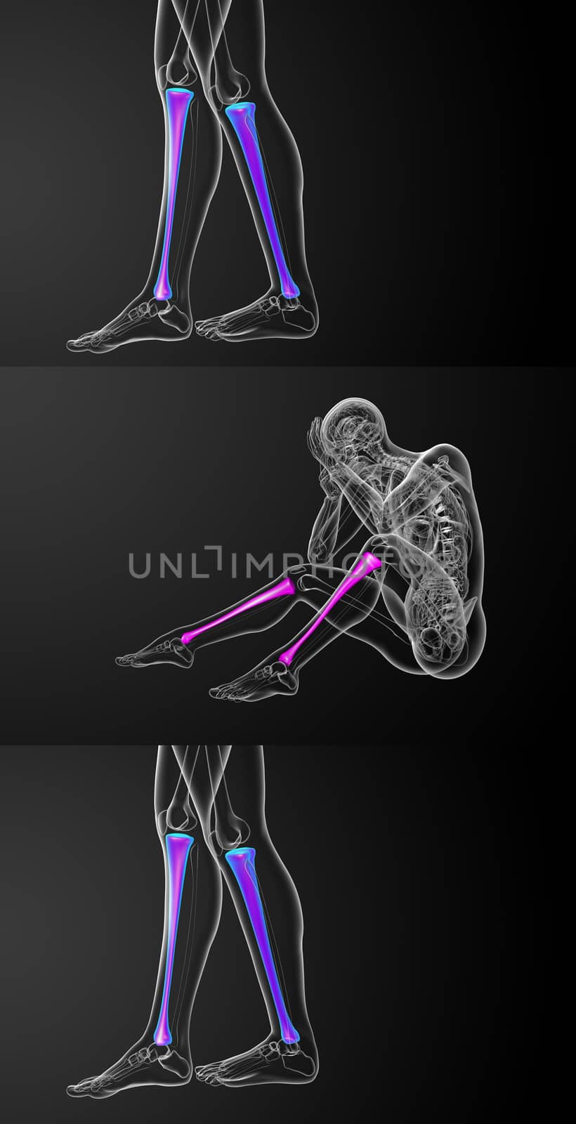 3d rendering medical illustration of the tibia bone 