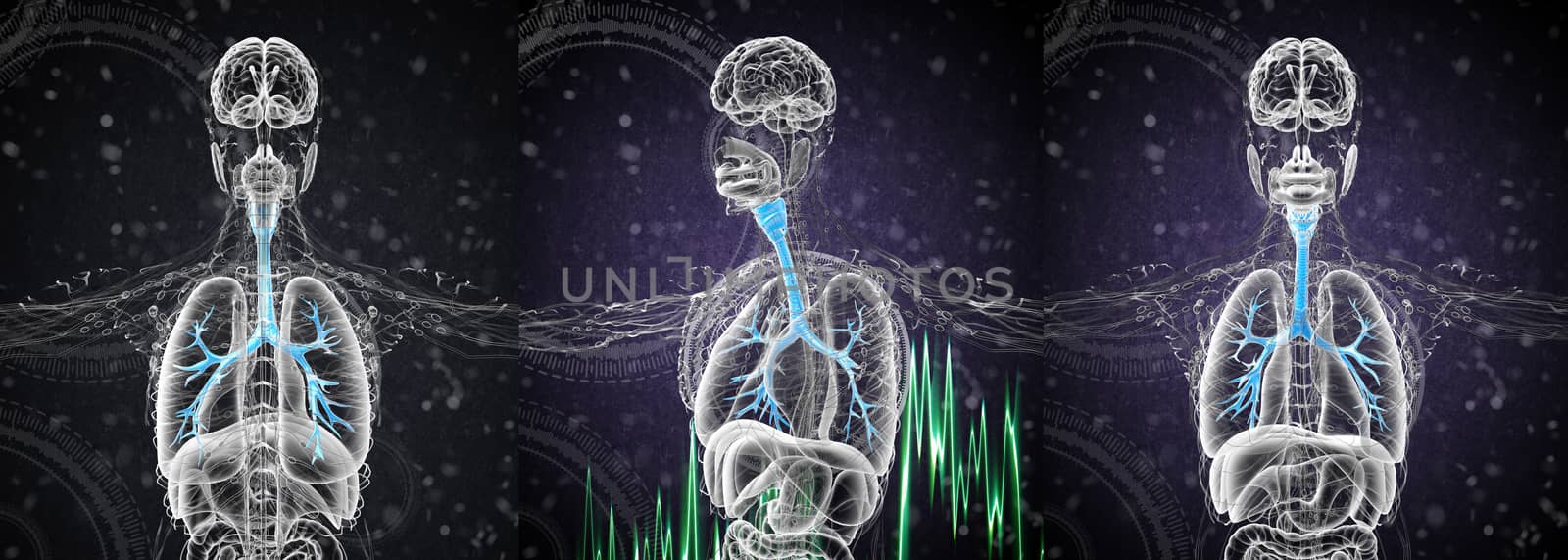 3D rendering medical illustration of the male bronchi