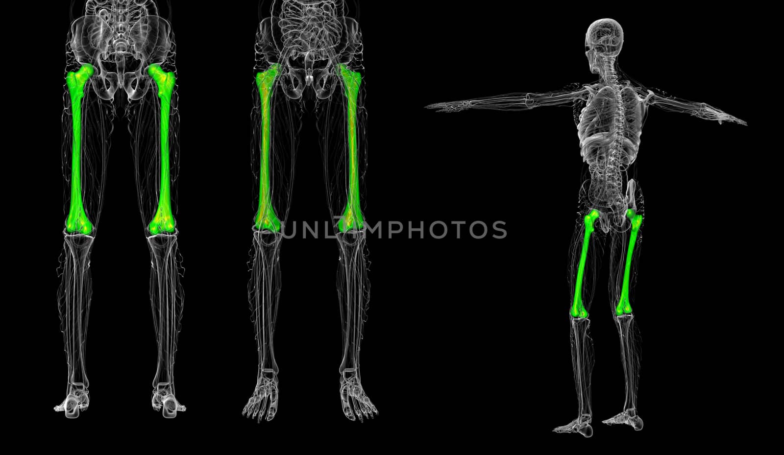 3d rendering medical illustration of the femur bone