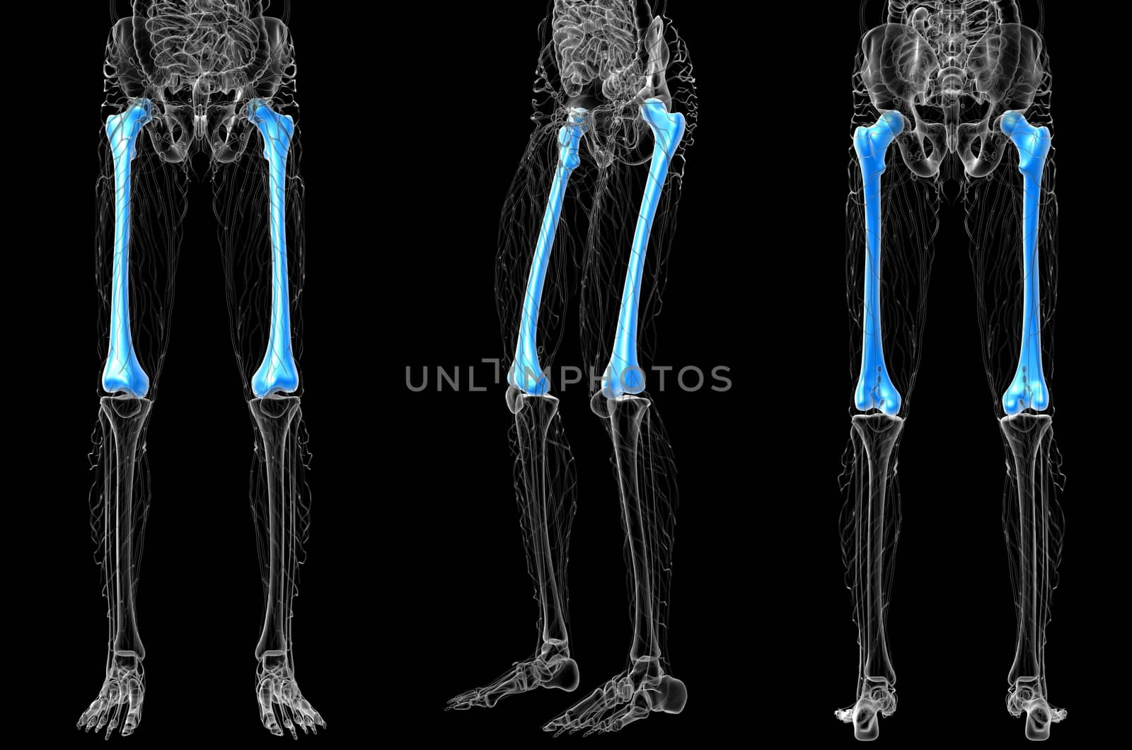 3d rendering medical illustration of the femur bone