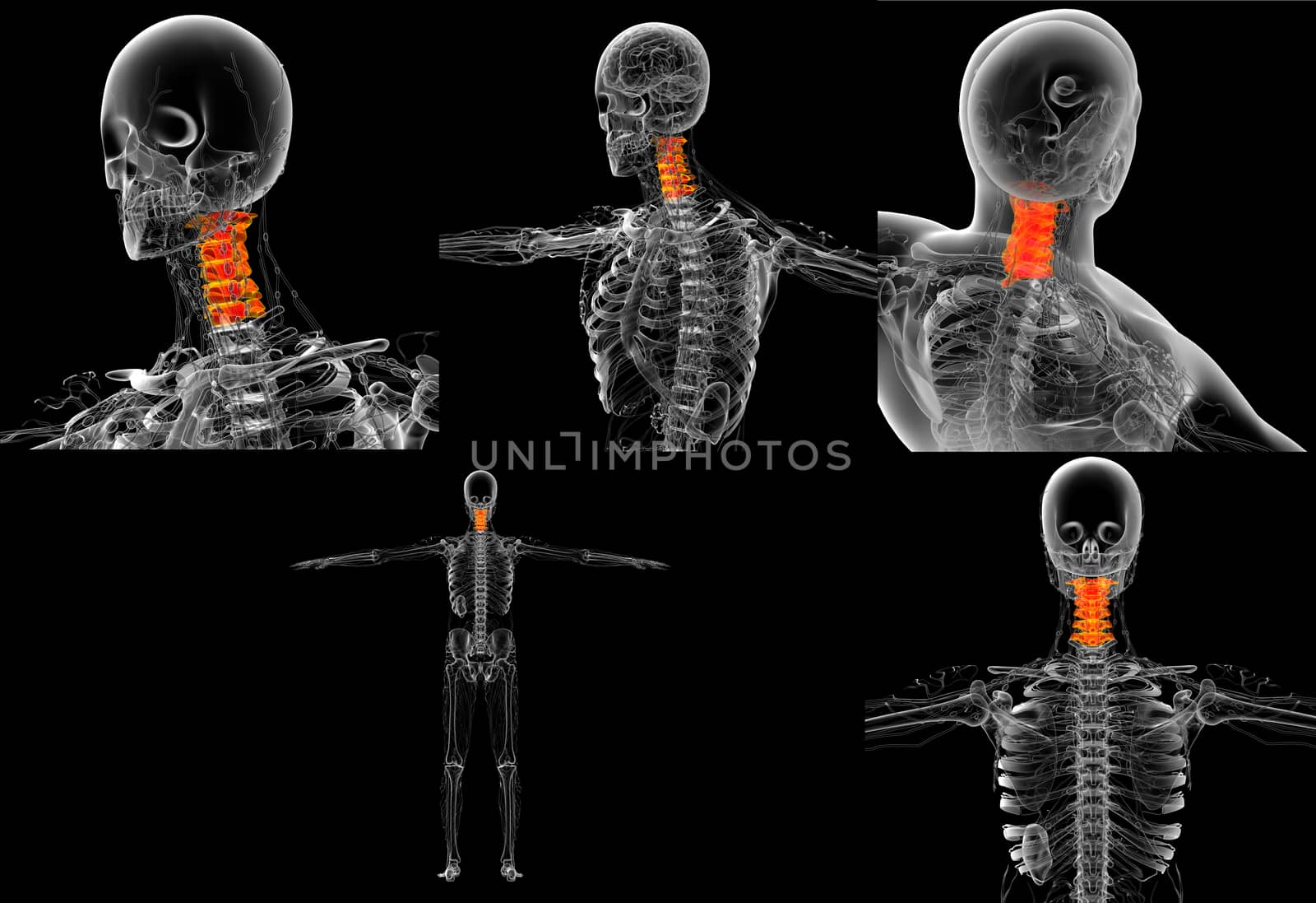 3d rendering medical illustration of the neck bone