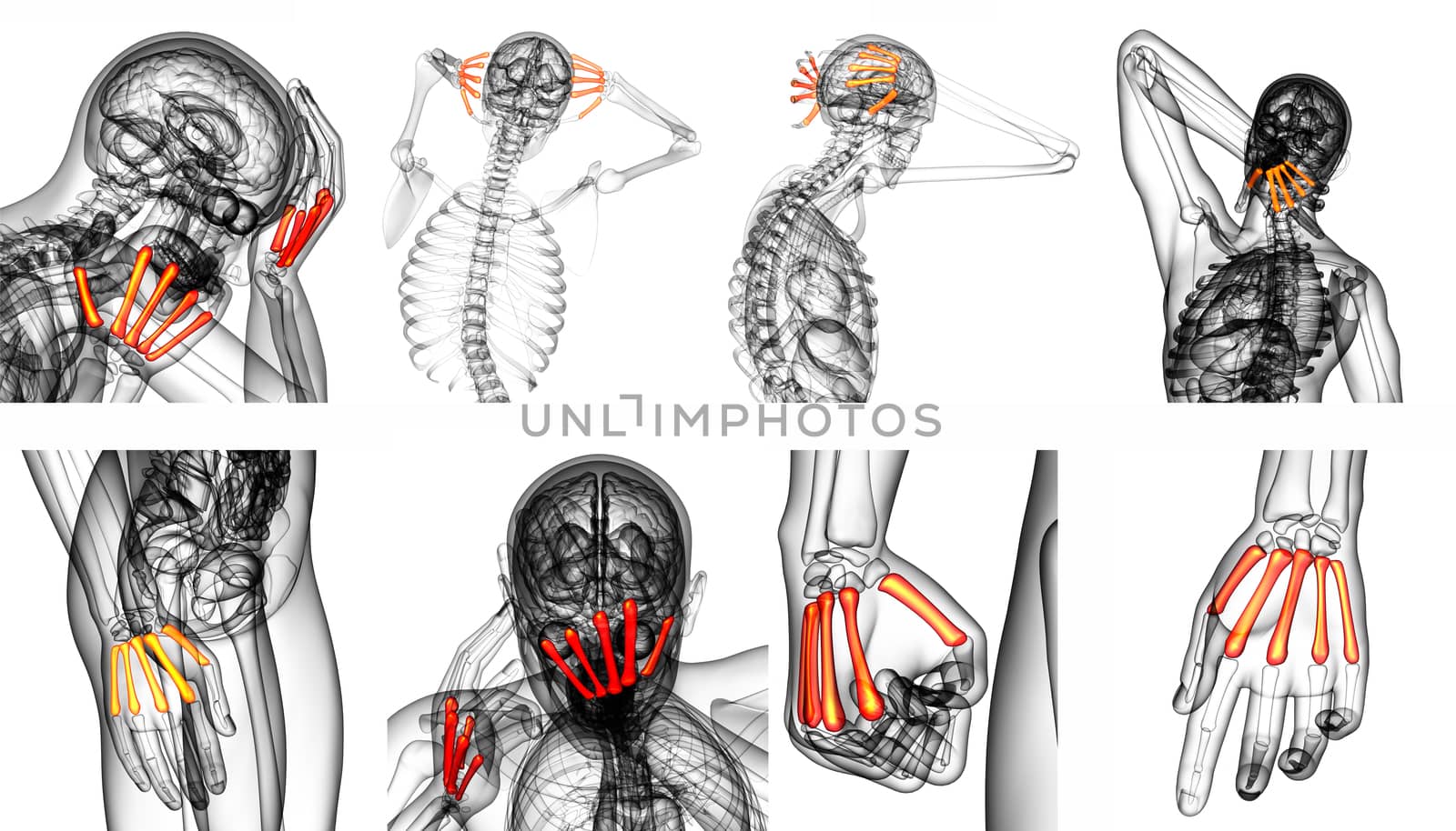 3d rendering medical illustration of the metacarpal bone 
