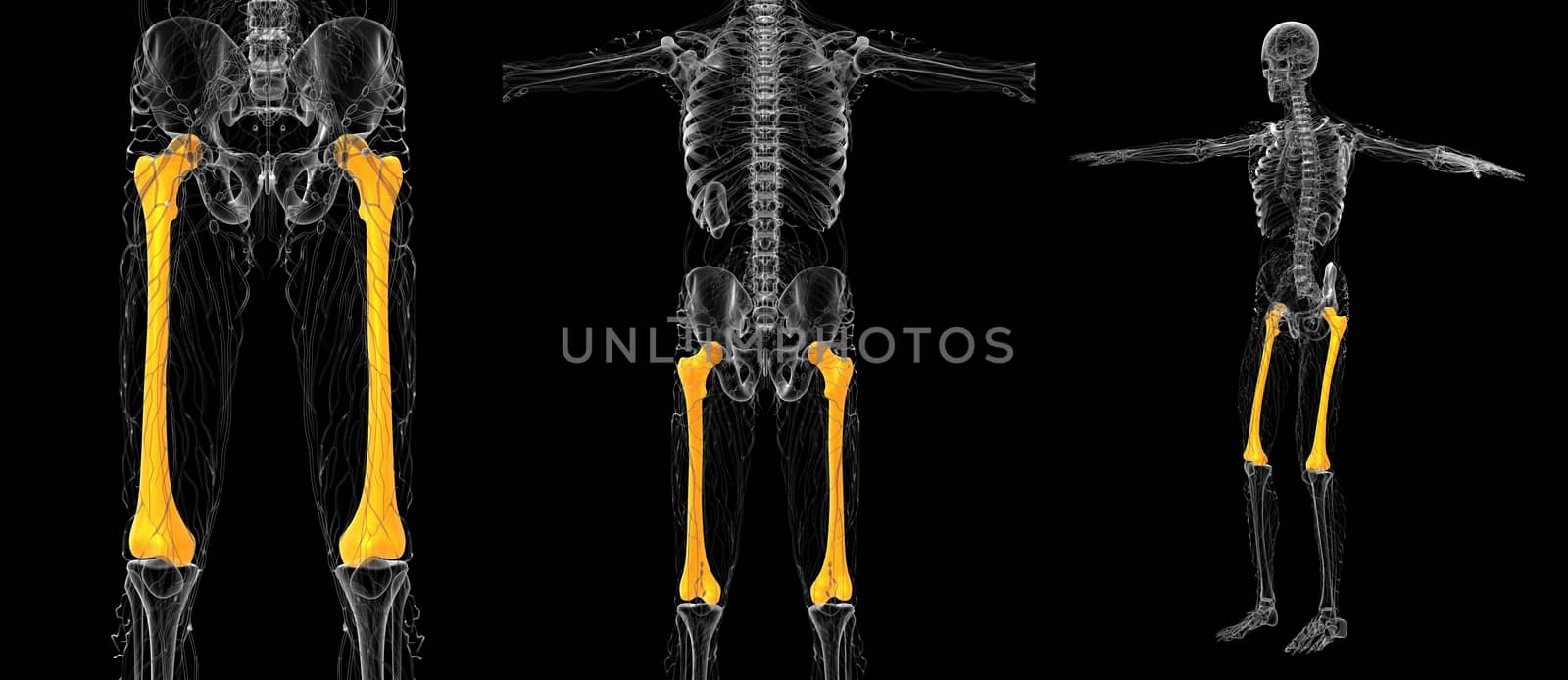 3d rendering medical illustration of the femur bone