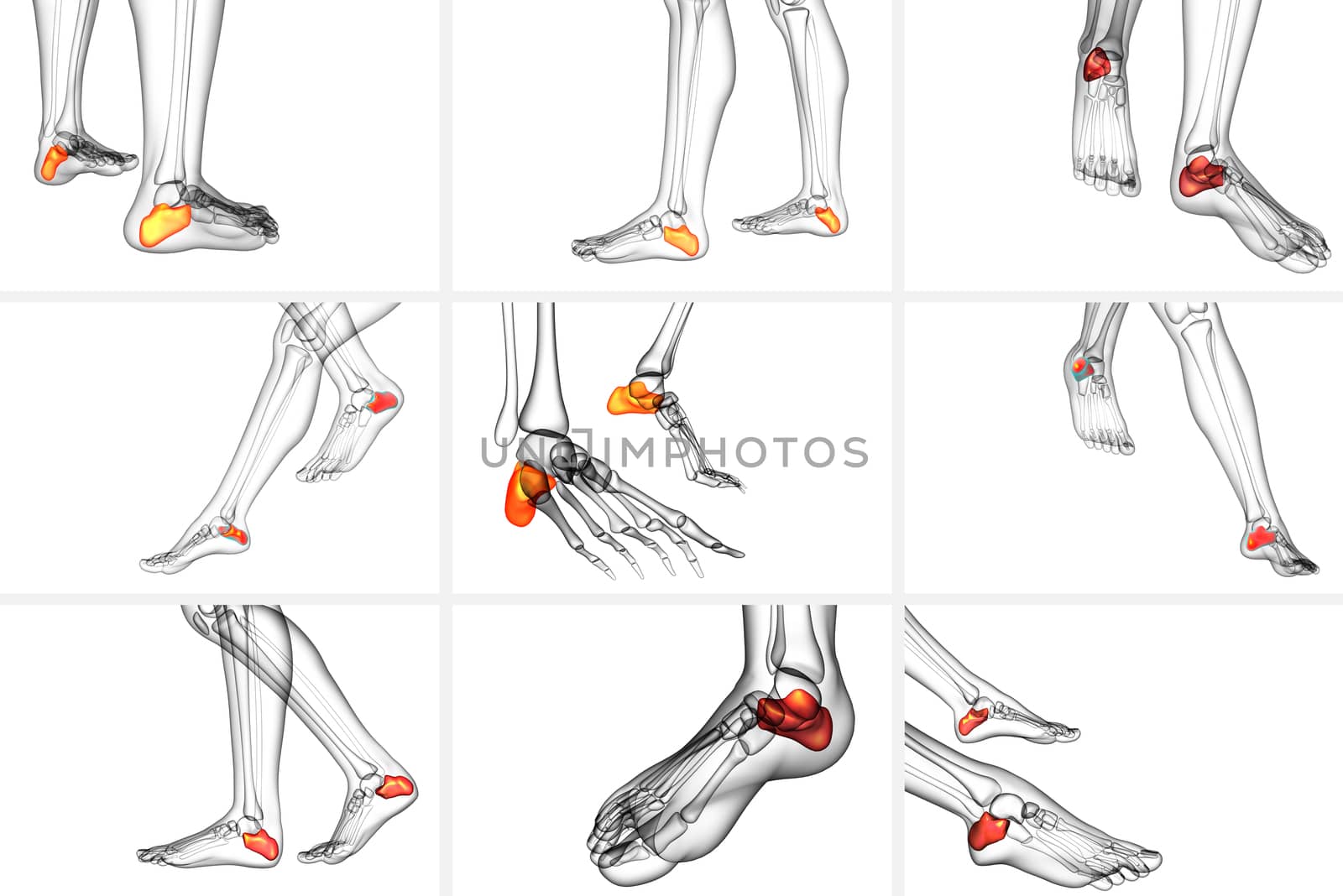 3d rendering medical illustration of the calcaneus bone