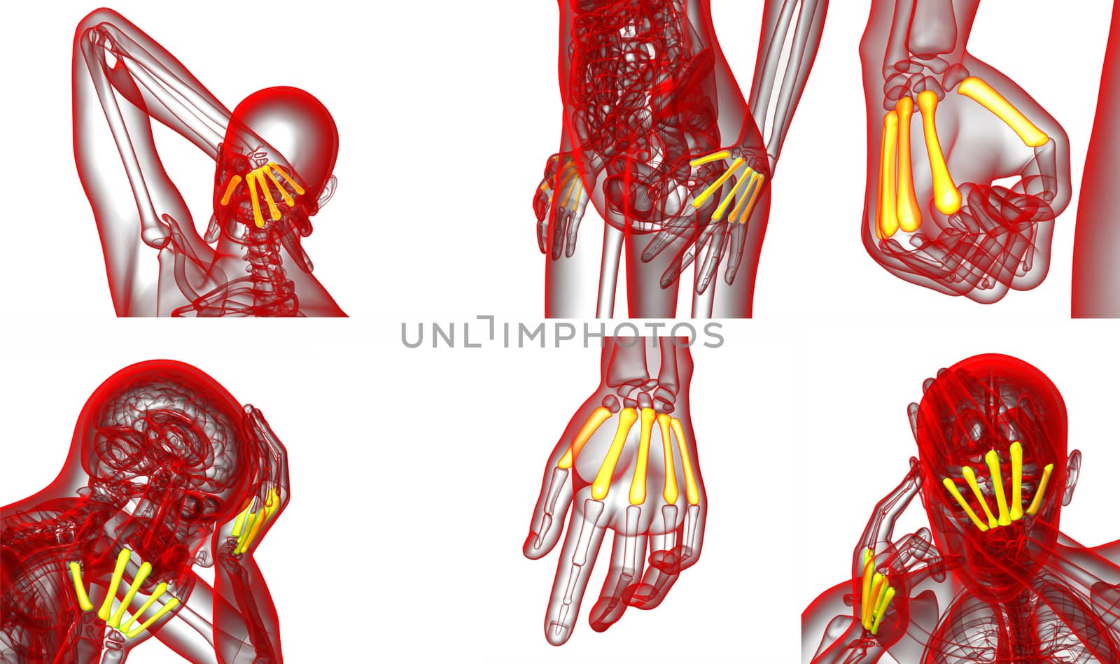 3d rendering medical illustration of the metacarpal bone 