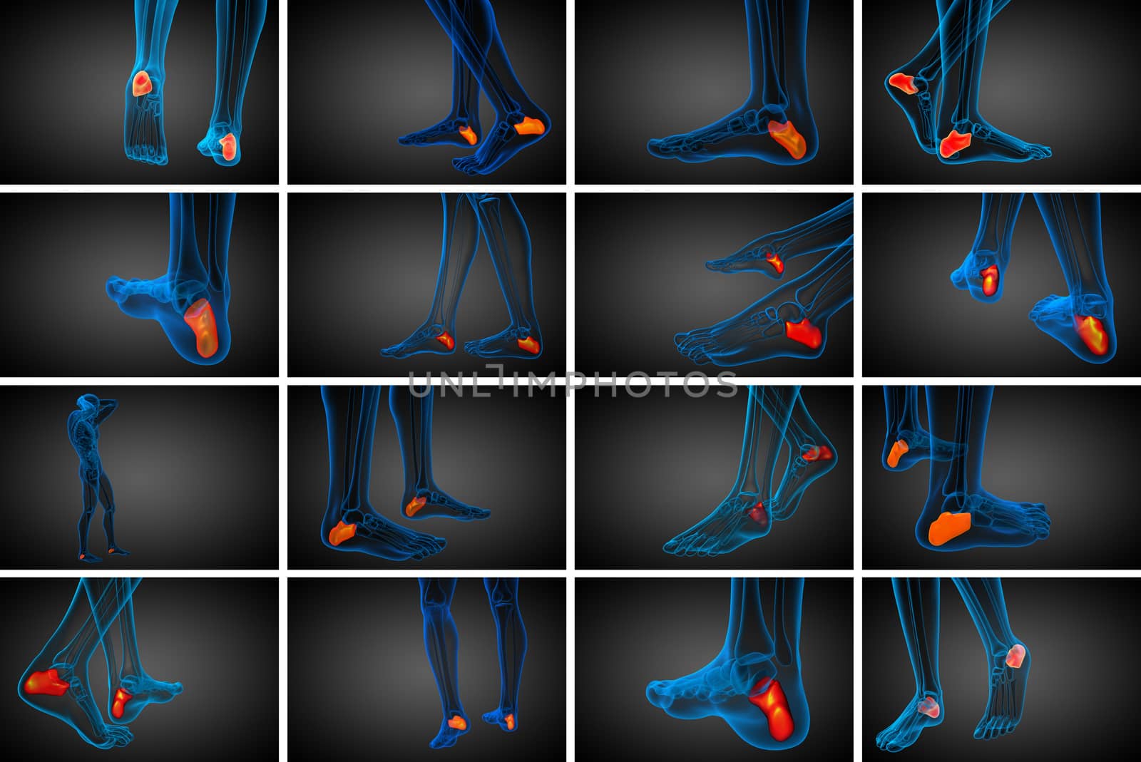 3d rendering medical illustration of the calcaneus bone