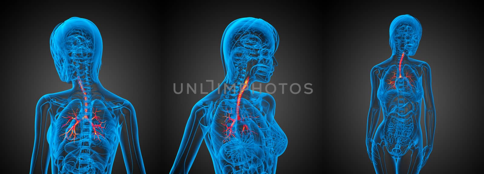 3D rendering medical illustration of the  bronchi 