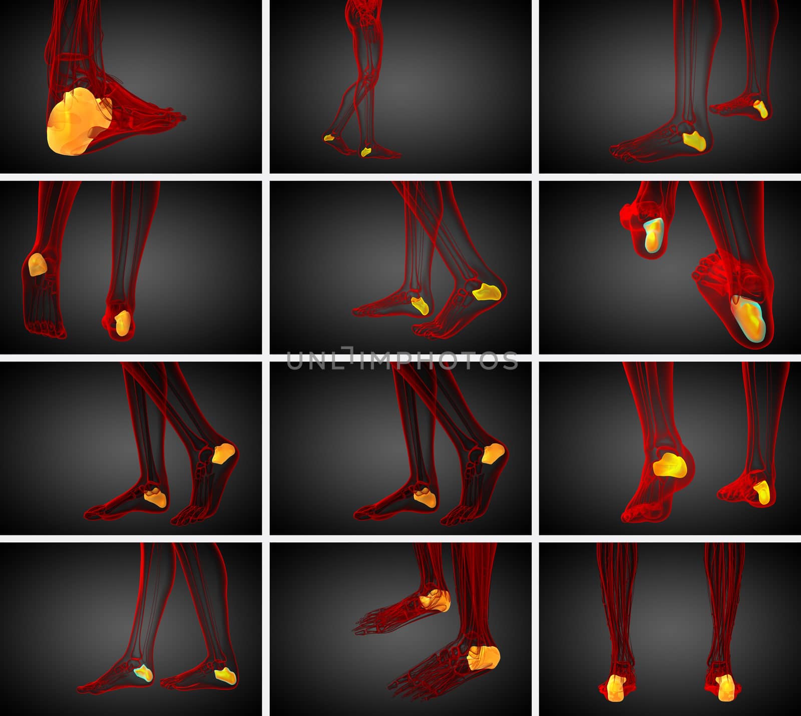 3d rendering medical illustration of the calcaneus bone