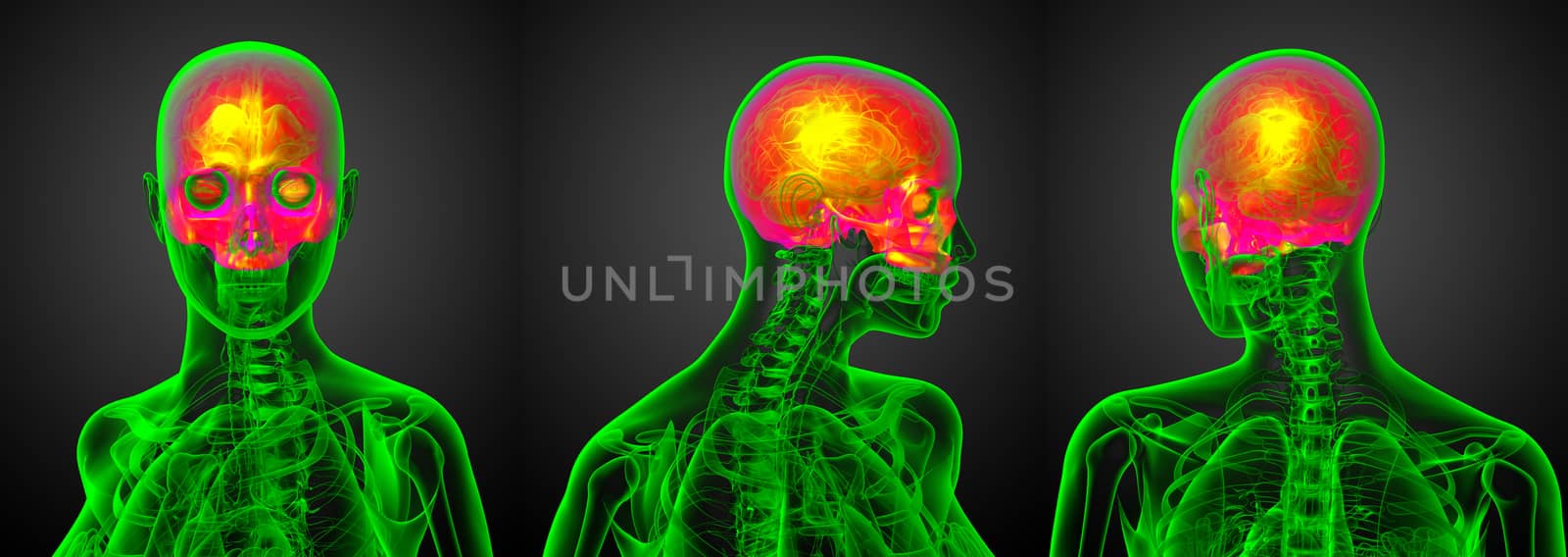 3d rendering medical illustration of the upper skull