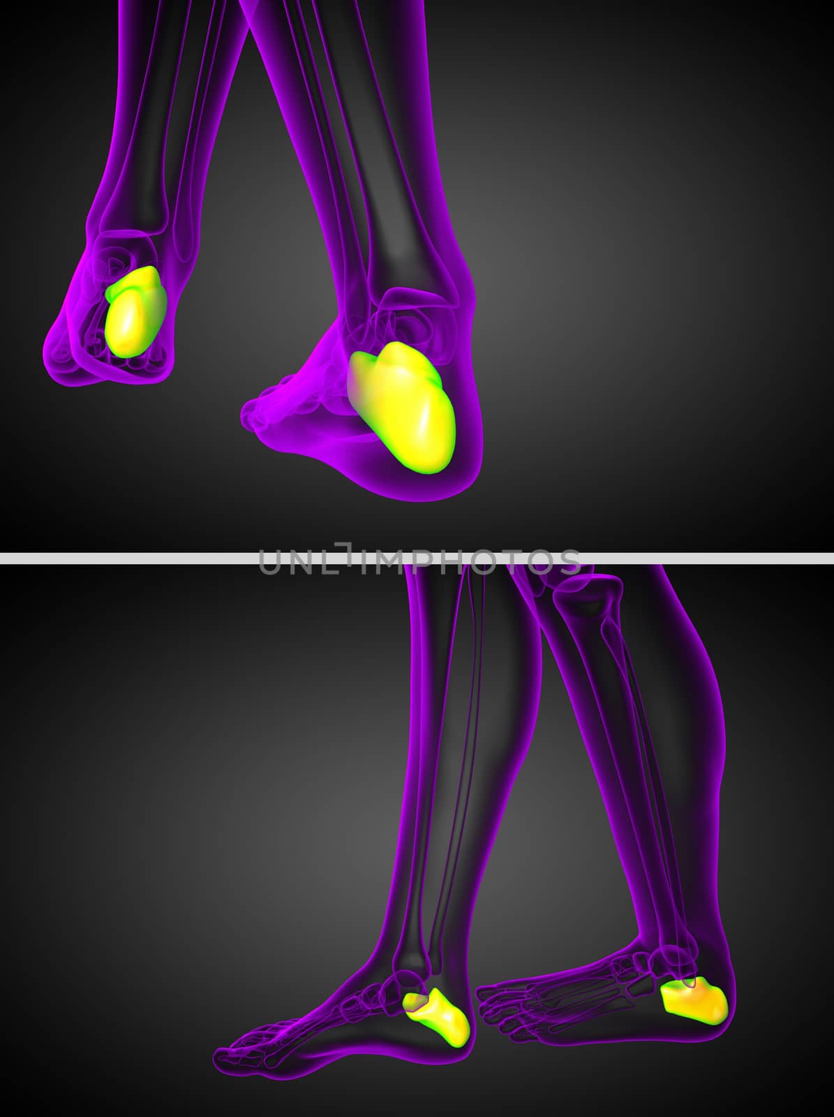 3d rendering medical illustration of the calcaneus bone