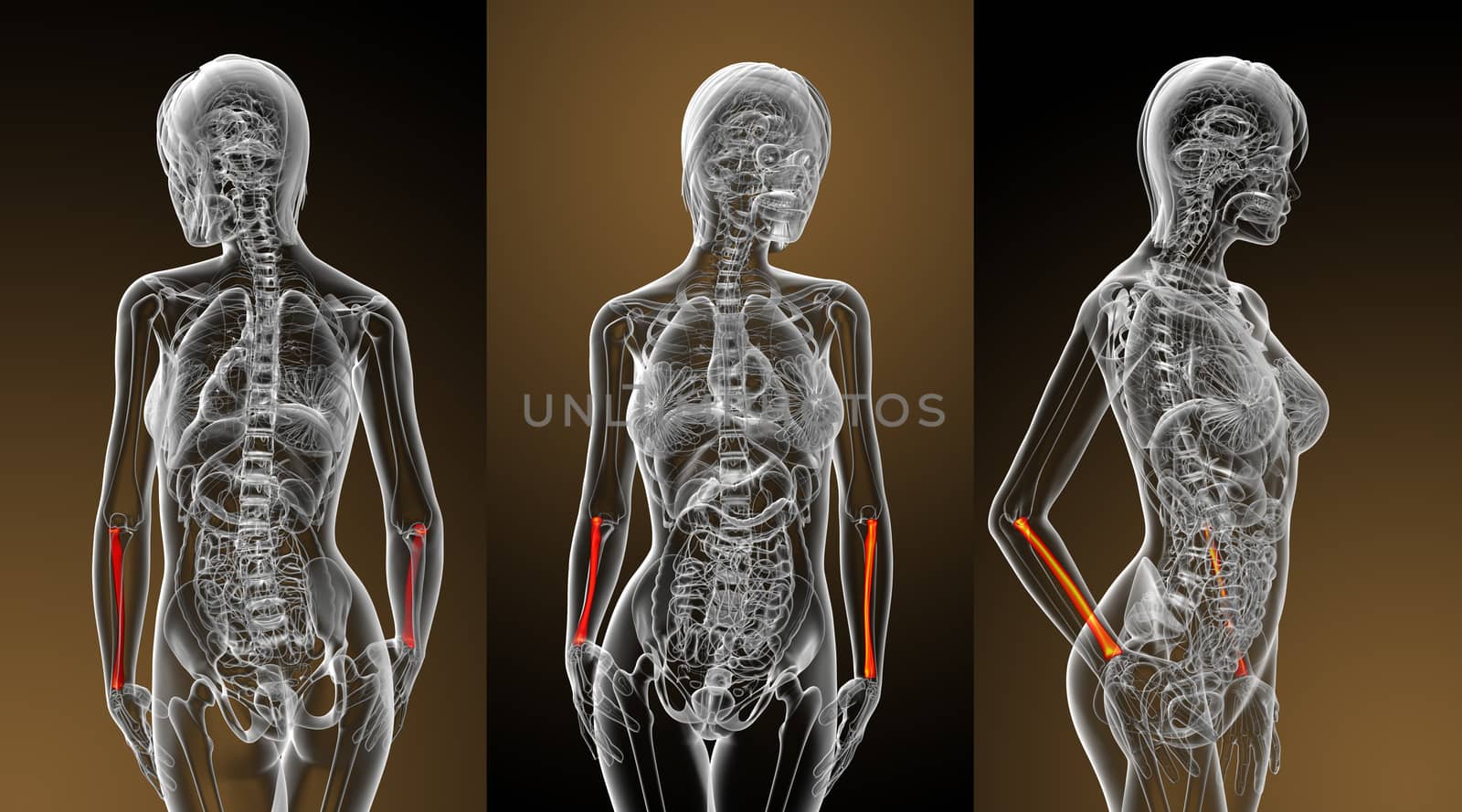 3d rendering medical illustration of the radius bone