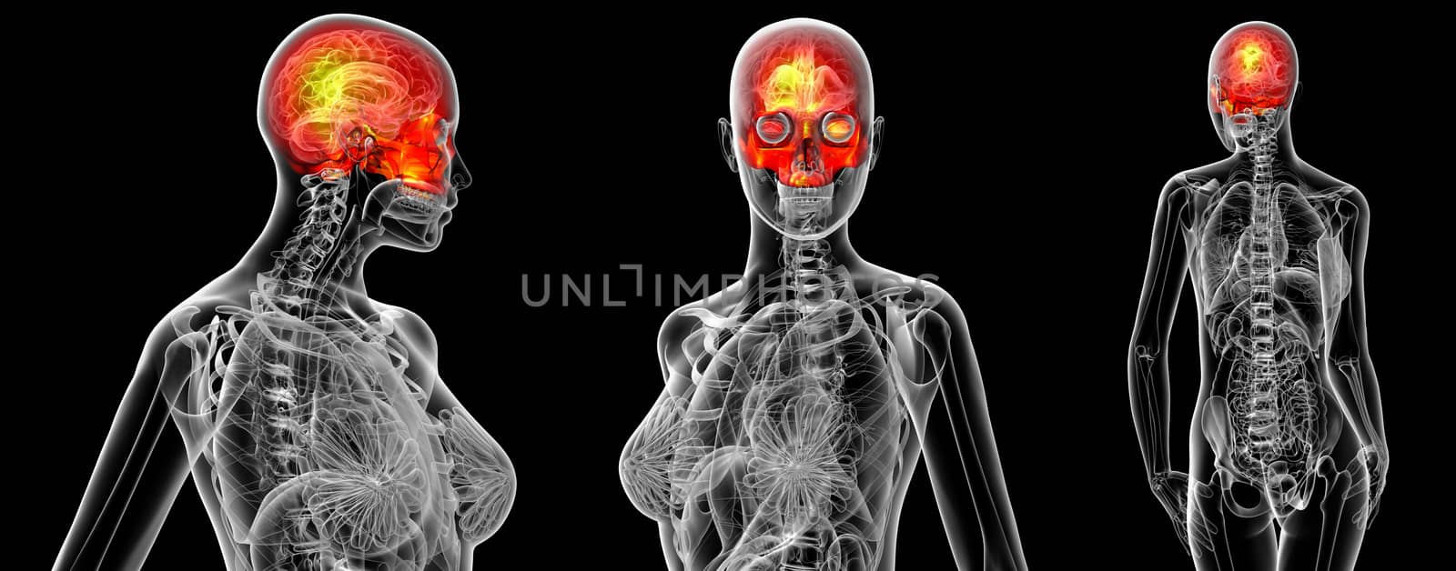 3d rendering medical illustration of the human skull 