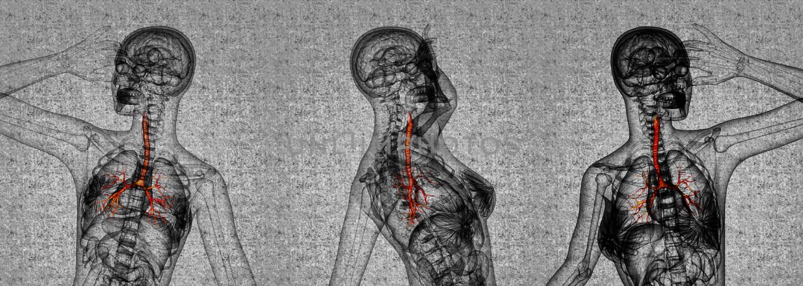 3D rendering medical illustration of the male bronchi 