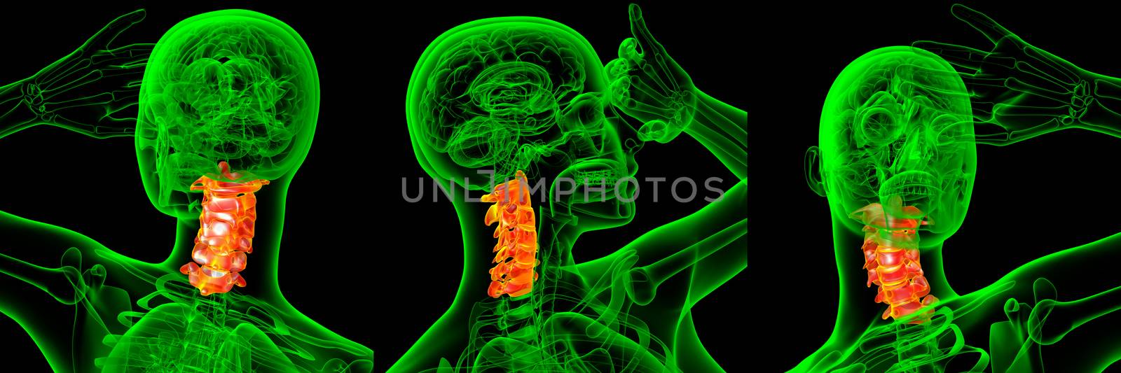 3d rendering medical illustration of the cervical spine