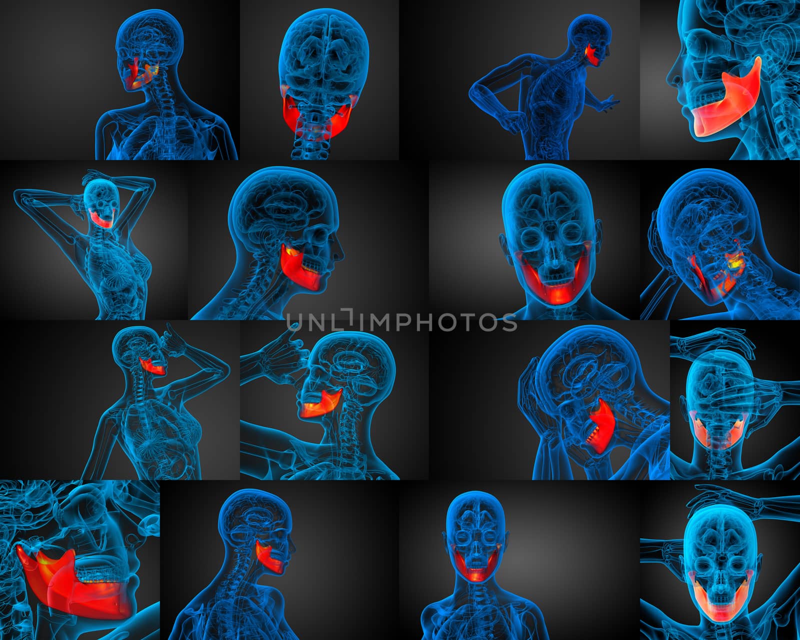 3d rendering illustration of jaw bone