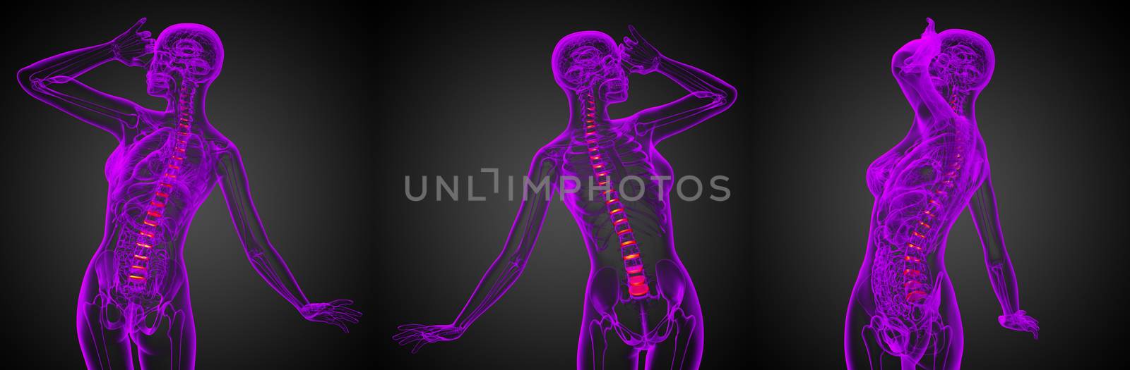 3D rendering medical illustration of the spinal disc
