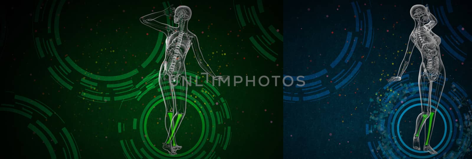 3d rendering medical illustration of the tibia 