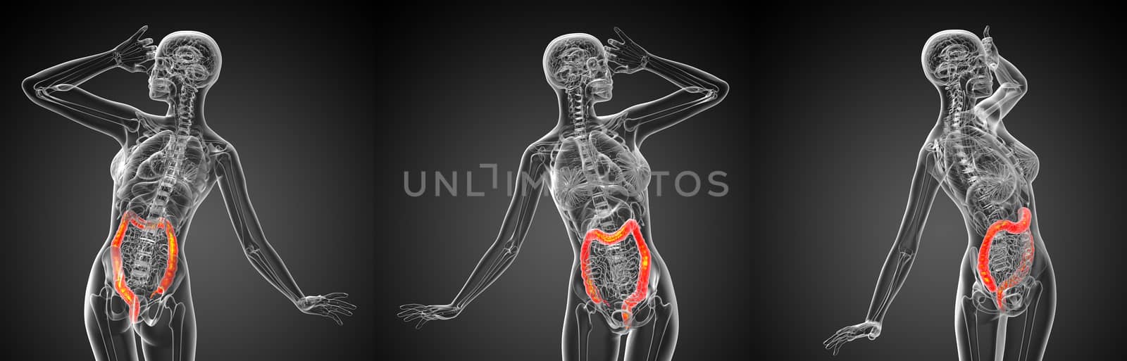 3d rendering medical illustration of the large intestine