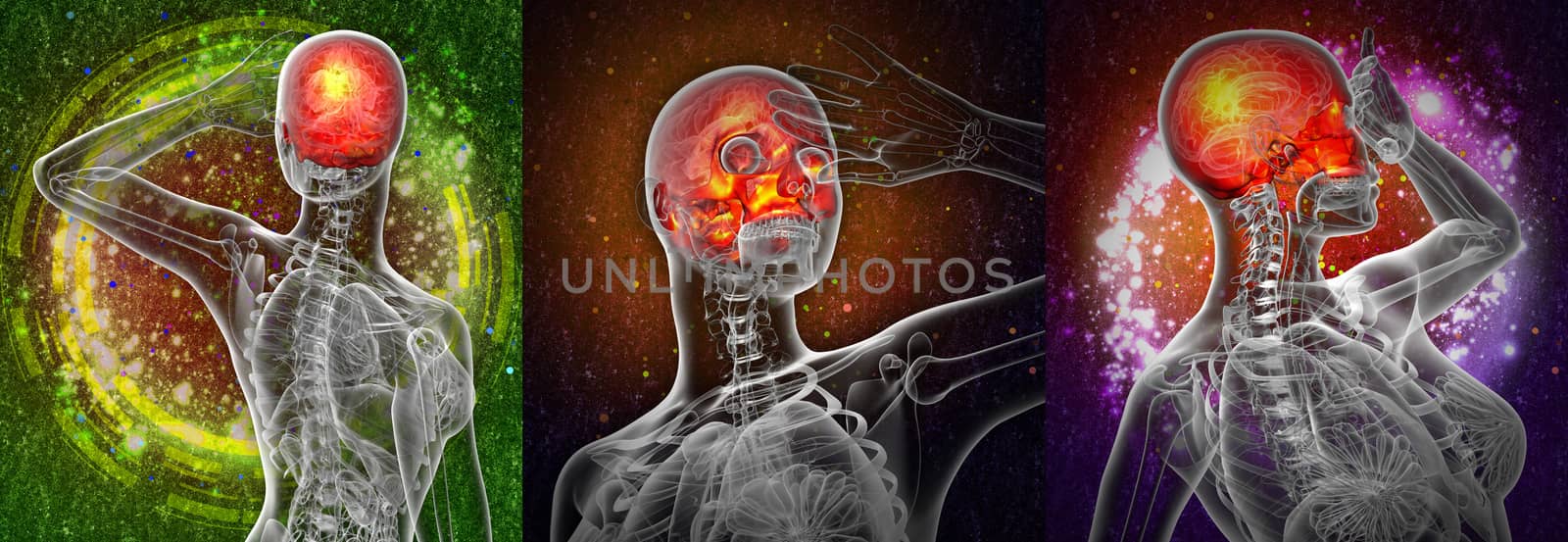 3d rendering medical illustration of the upper skull 