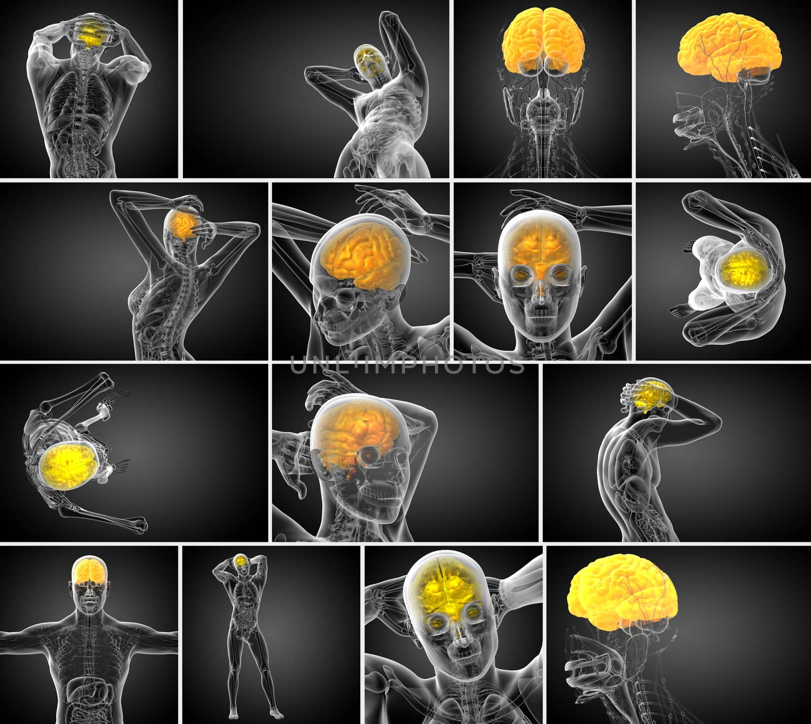 3d rendering medical illustration of the brain