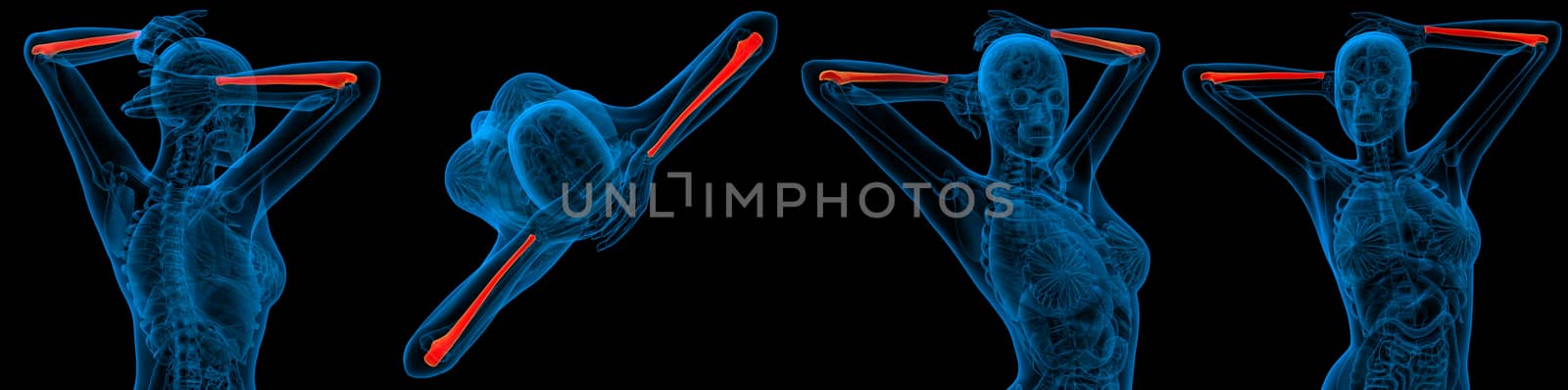 3d rendering medical illustration of the ulna bone