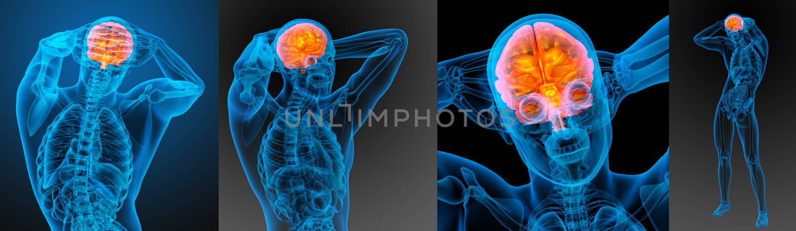 3d rendering medical illustration of the human brain