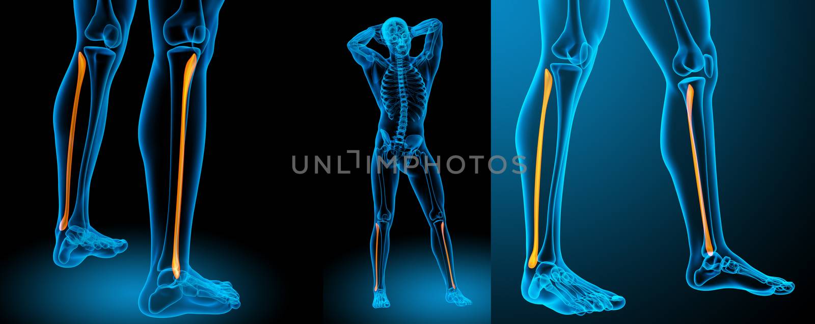 3d rendering medical illustration of the tibia 