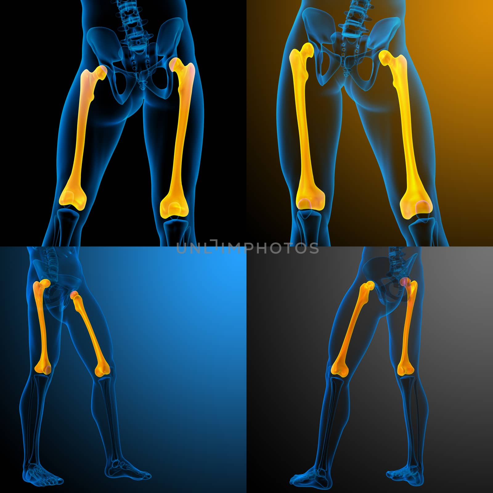 3d rendering medical illustration of the femur bone