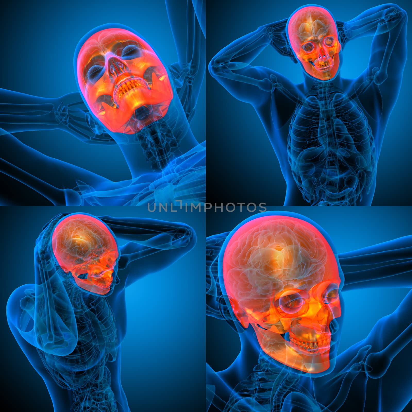 3d rendering medical illustration of the human skull 