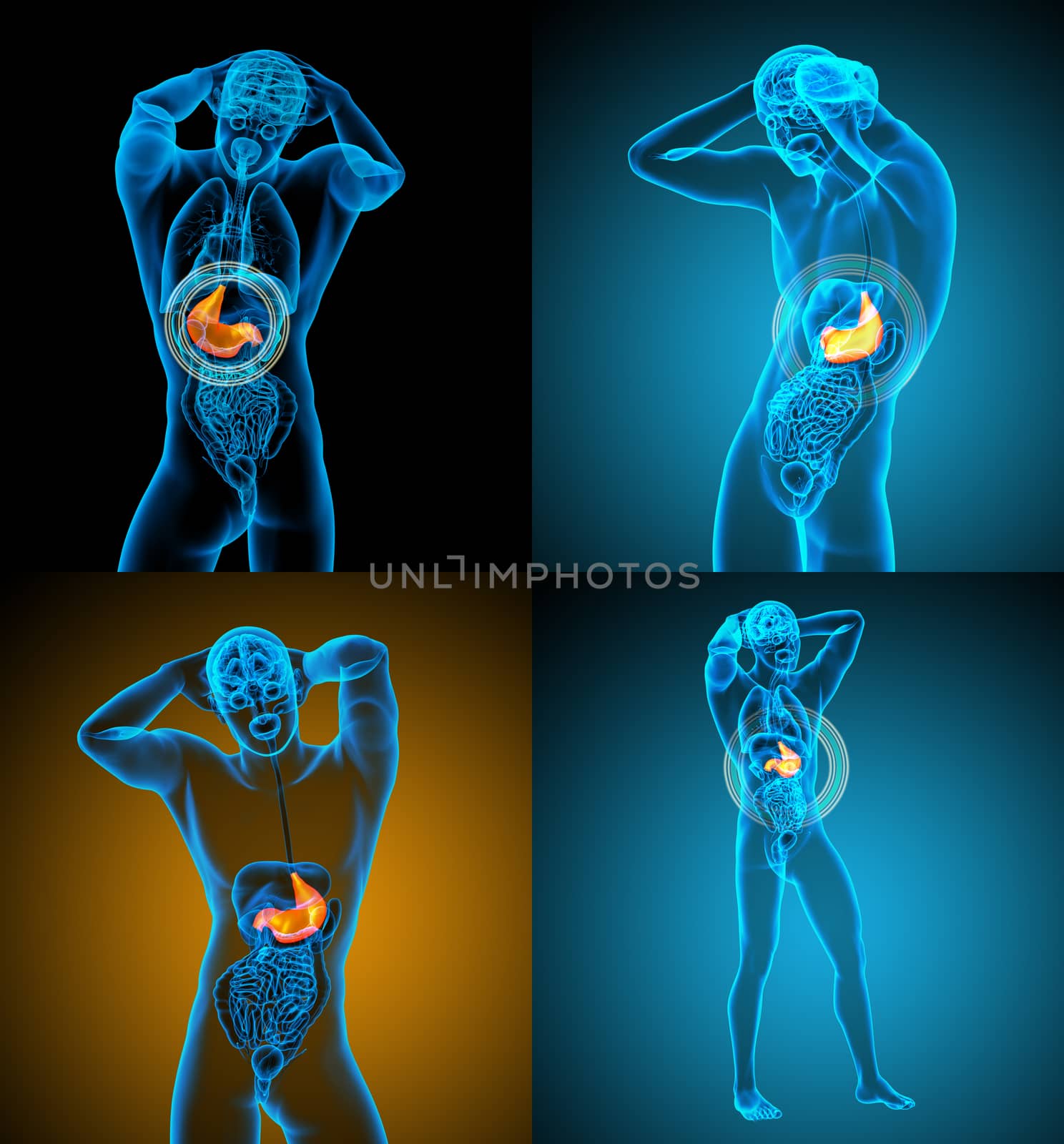 3d rendering medical illustration of the stomach