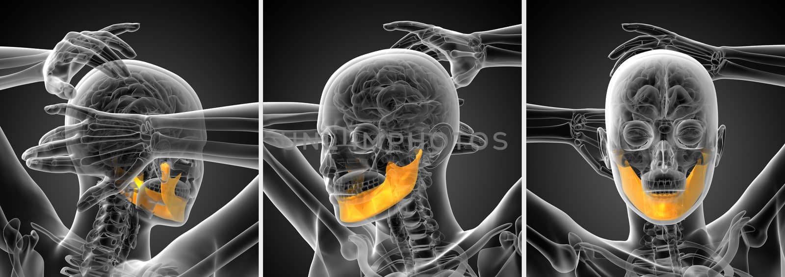 3d rendering illustration of a jaw bone by maya2008