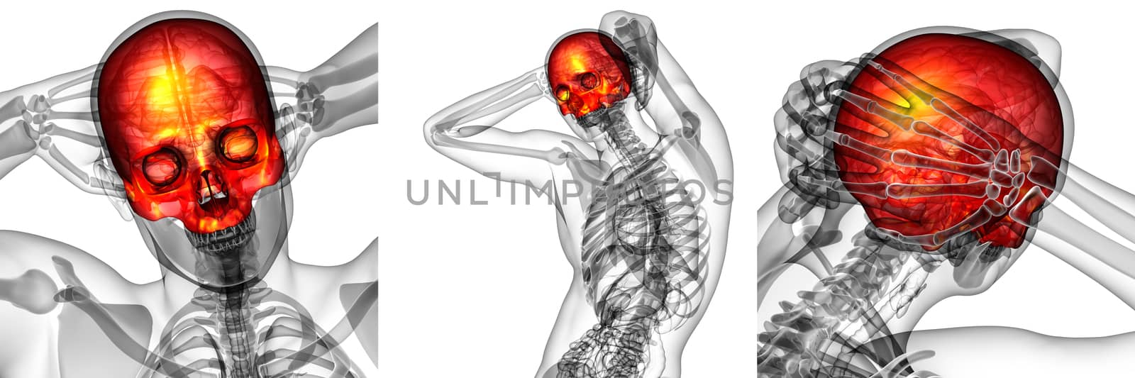 3d rendering medical illustration of the upper skull 
