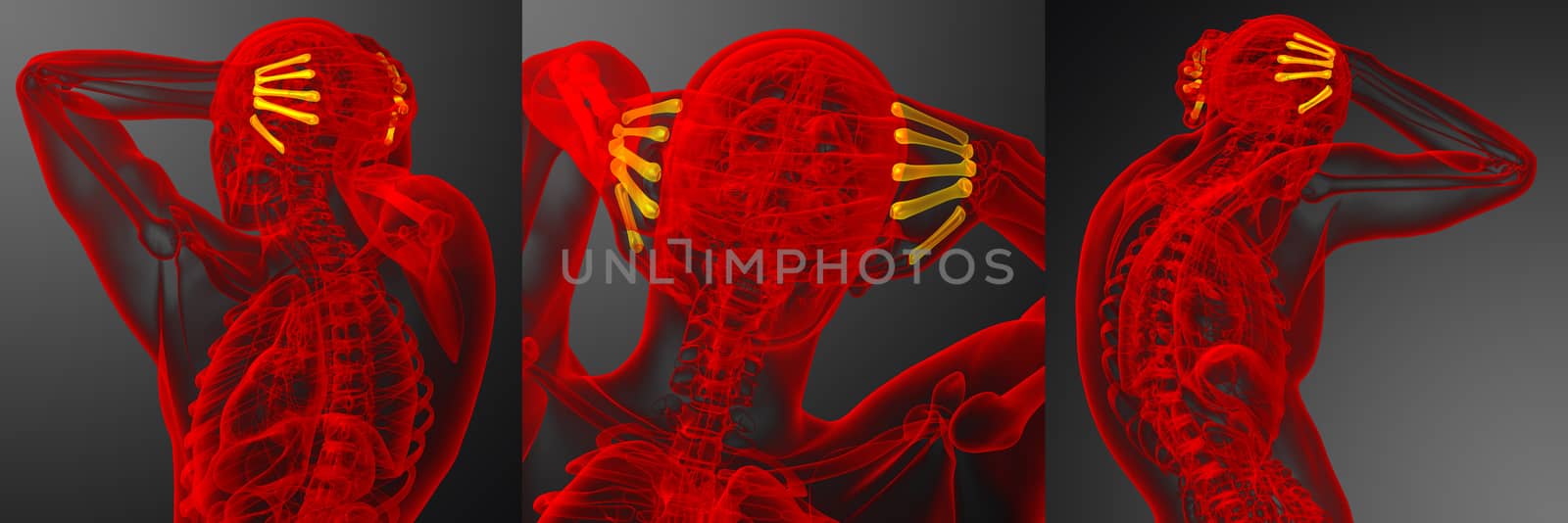 3d rendering medical illustration of the metacarpal bone