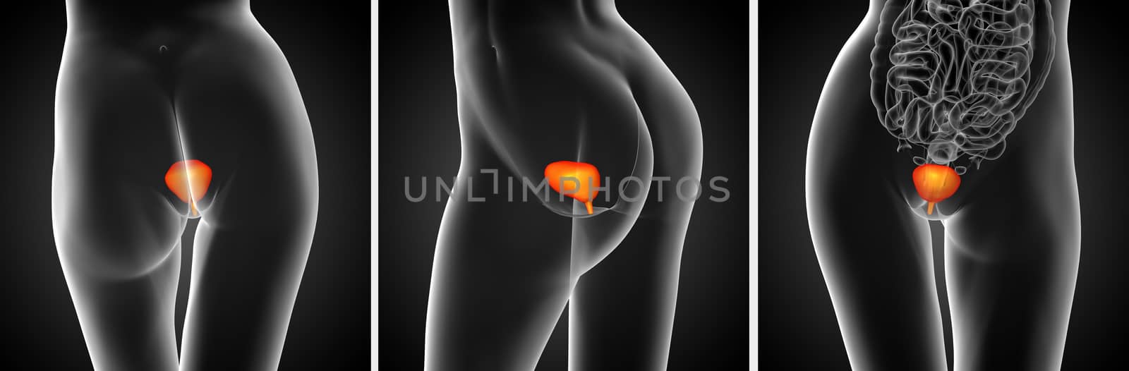 3d rendering medical illustration of the bladder