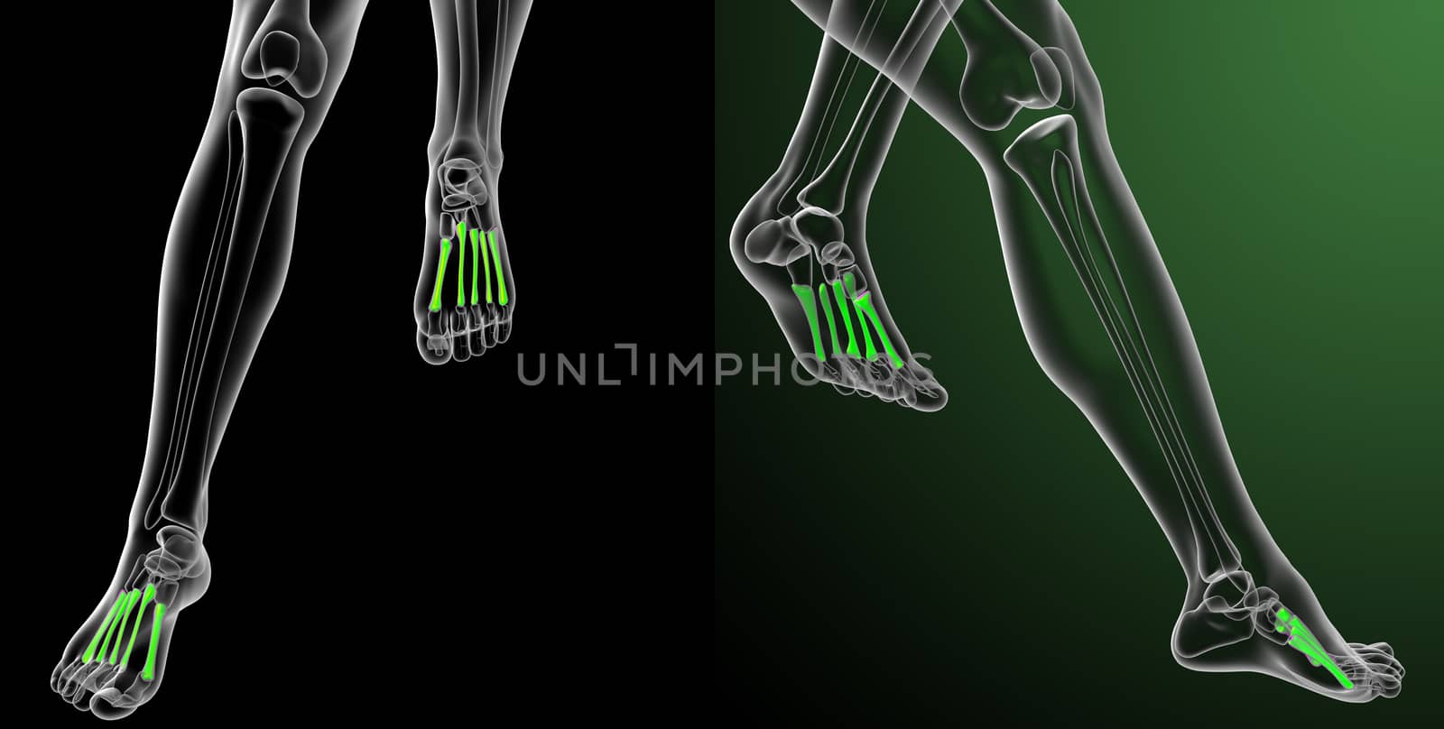 3d rendering medical illustration of the metatarsal bones 