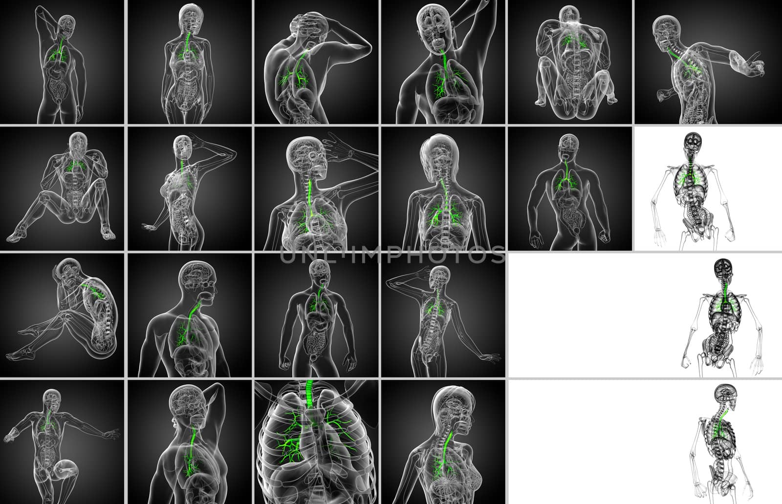 3d rendering  medical illustration of the male bronchi 
