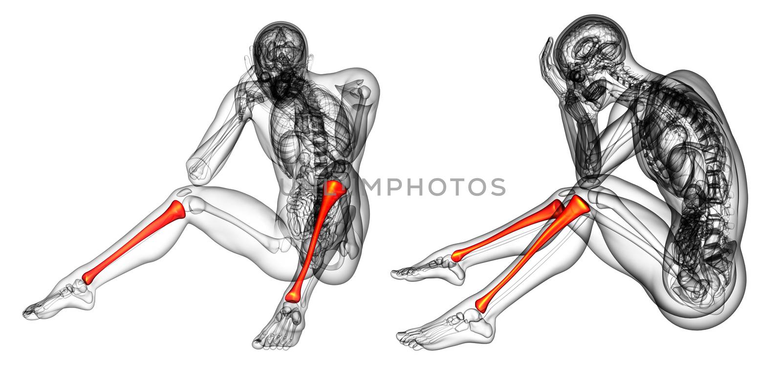 3d rendering medical illustration of the tibia 