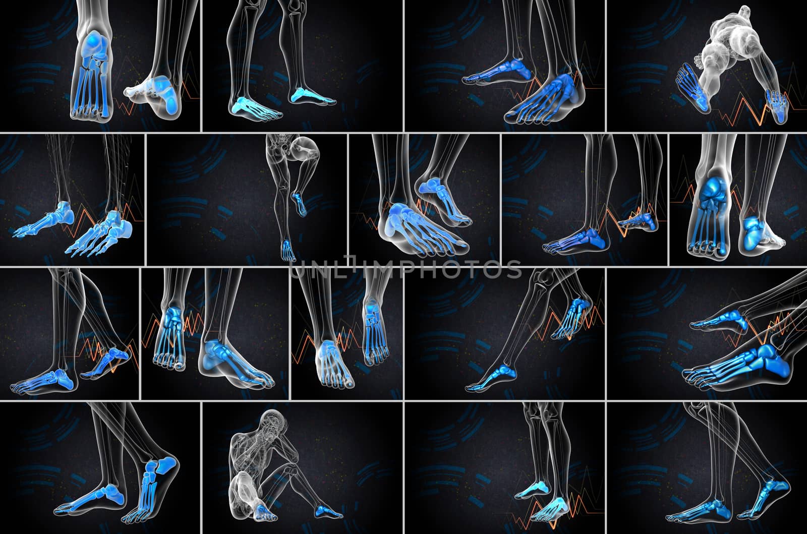 3d rendering medical illustration of the foot bone 