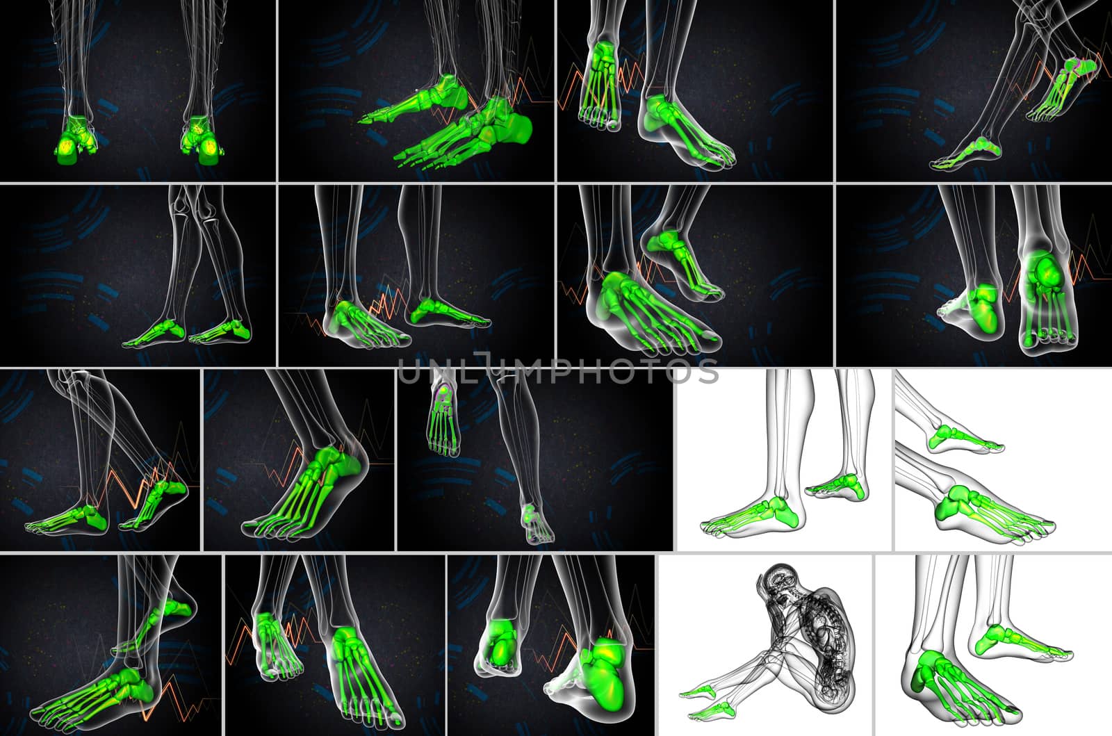 3d rendering medical illustration of the foot bone 