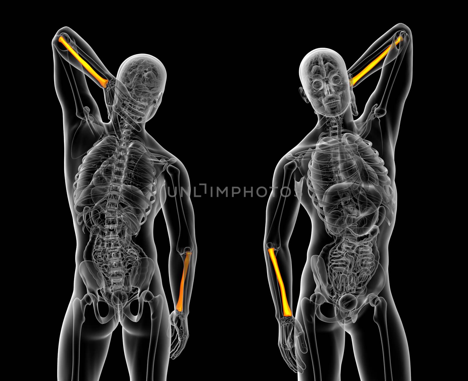 3d rendering medical illustration of the radius bone